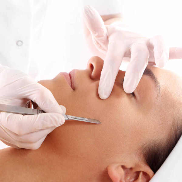 Dermaplaning