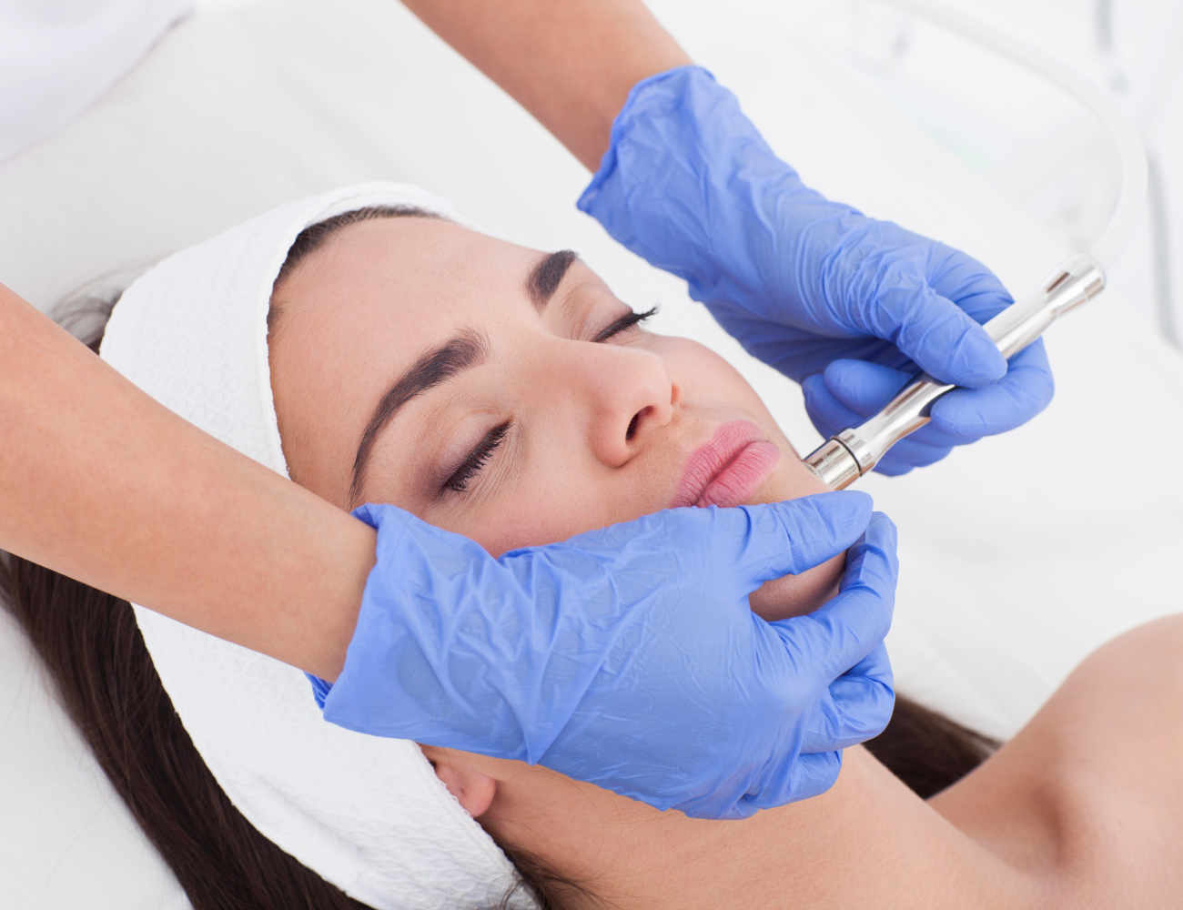 Diamond Microdermabrasion